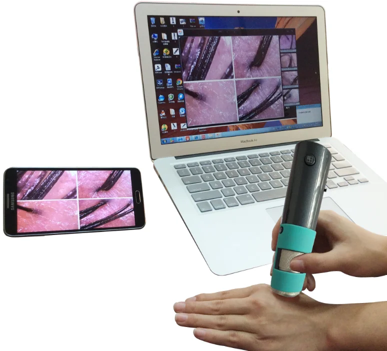 

600x high-definition scalp detector
