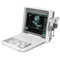 12 1 s990 plus handheld high image quality hospital clinic use portable ultrasound machine ultrasound scanner