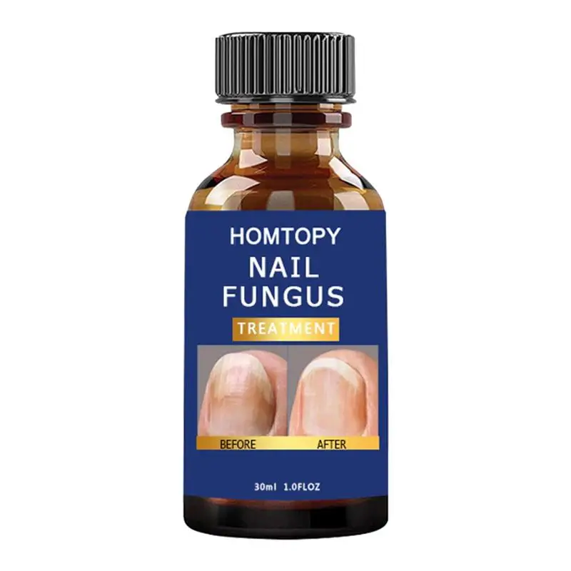 

Отвердитель ногтей Sdotter, усилитель ногтей для тонких ногтей и восстановления ногтей для быстрого и крепкого восстановления внешнего вида н...