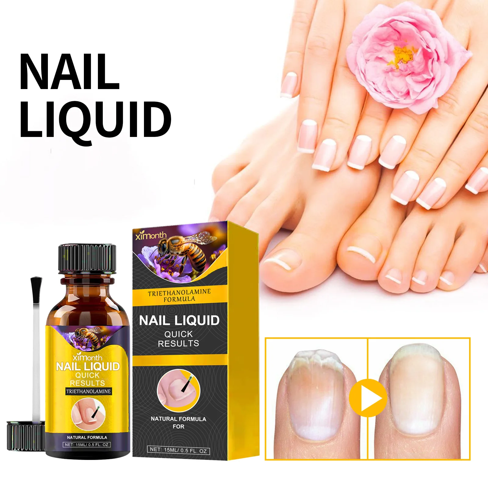 онихомикоз удаление рук ног ремонт уход за ногтями лечение грибка паронихии