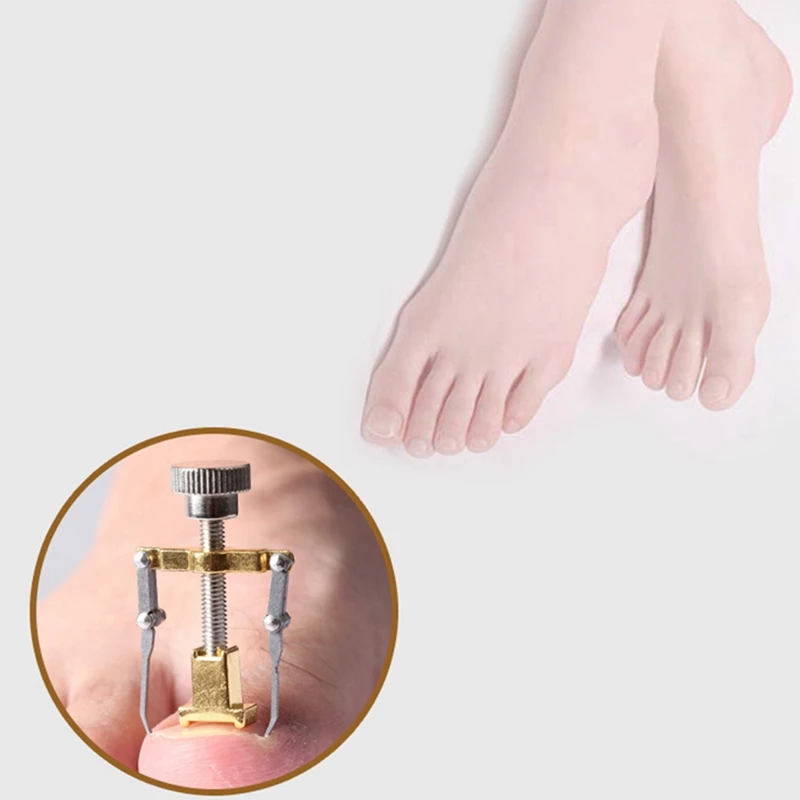 

2X Ingrown Toenails Toe Nail Care Tool Professional File Corrector Device Pedicure Foot Bunion Corrector Protector Gold