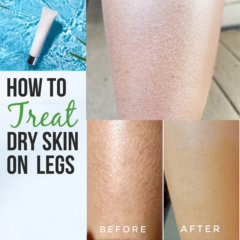 

Moisturizing Cream Grapefruit Get Rid of Dry Flaky Legs Increase Elasticity Locks Moisture Gain Soft Smooth Skin Winter Skincare