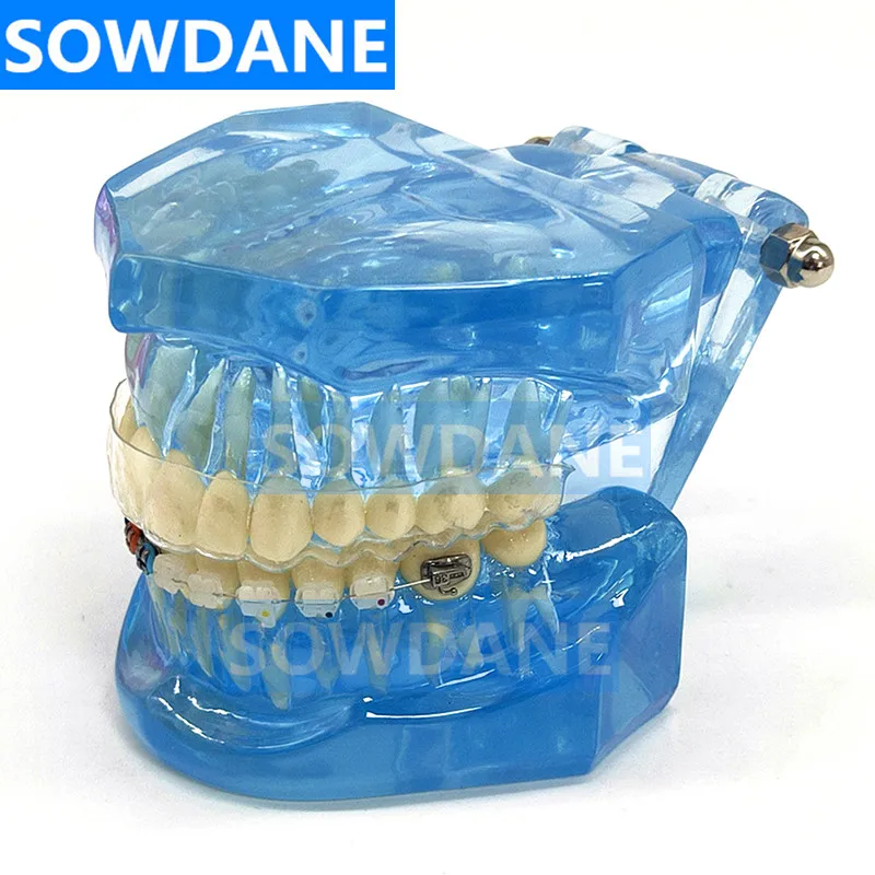 Новая Стоматологическая Ортодонтическая модель зубов для общения с пациентом