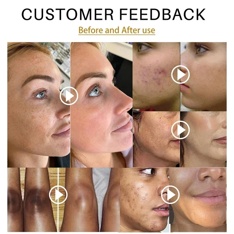 Рисунок 2 - Для удаления темных пятен куркума