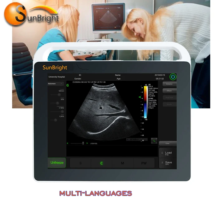

ultrasound biopsy needle guide Discount price Portable 15" screen Ultrasound