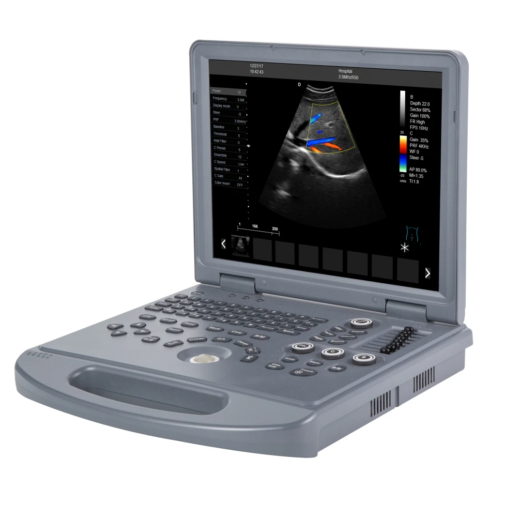 

Low price medical laptop color doppler ultrasound scanner with convex probe