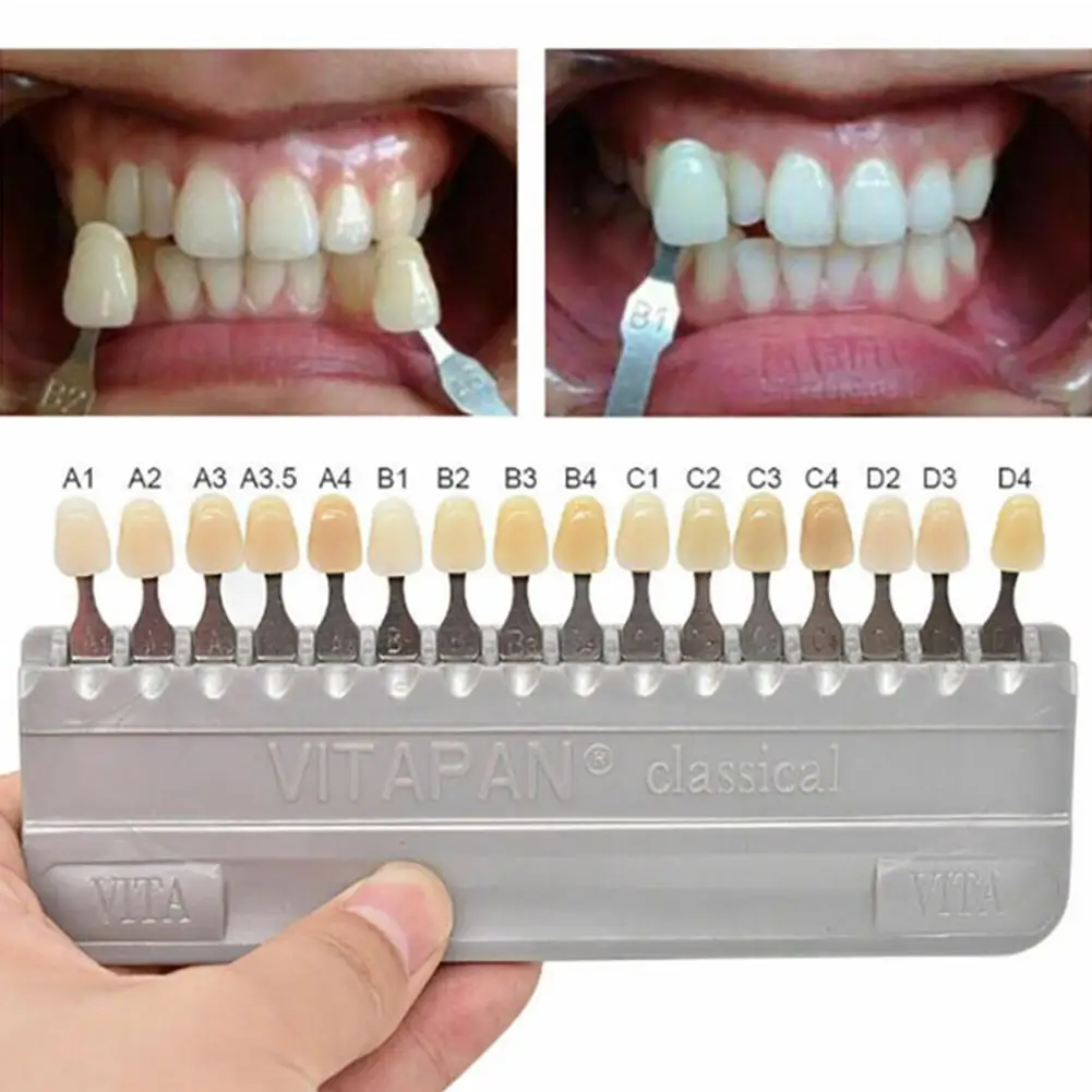 

Dental Shape Guide 16 Colors Tooth Guide 3D Master Teeth Color Plate Comparator Dentistry Clinic Whitening Surgical Tool