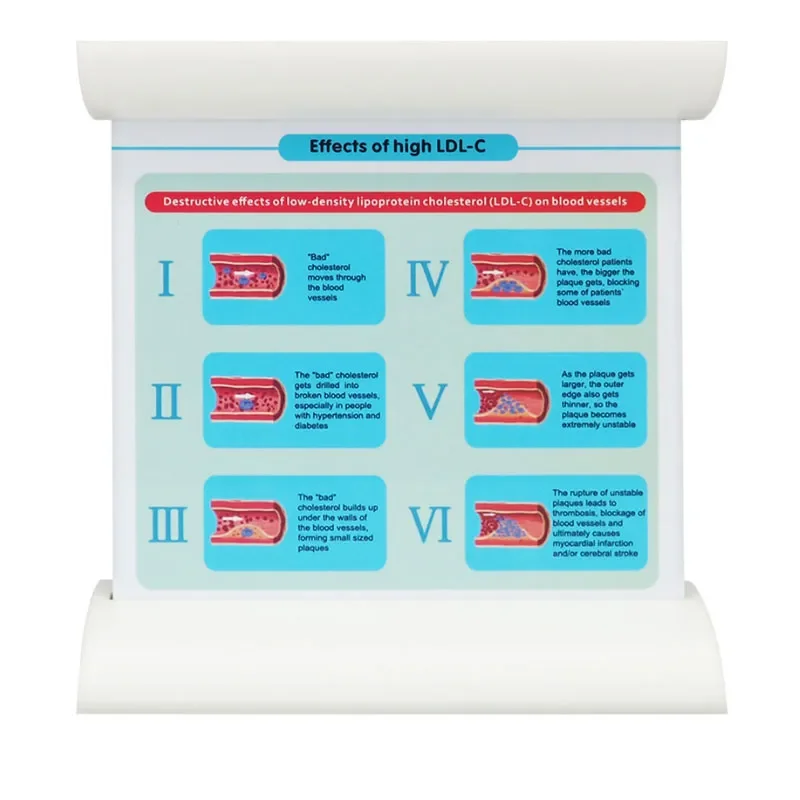 Трехсудочная модель сосудистый: здоровая артерия и симуляция блокировки в