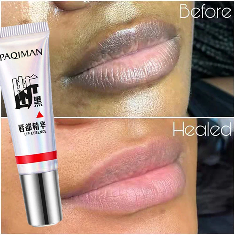 

Moisturizing Lip Balm Brighten Removal Black Stain Nourish Fade Lip Lines Whitening Improve Dull Dry Lips Skin Care Gel Lipstick