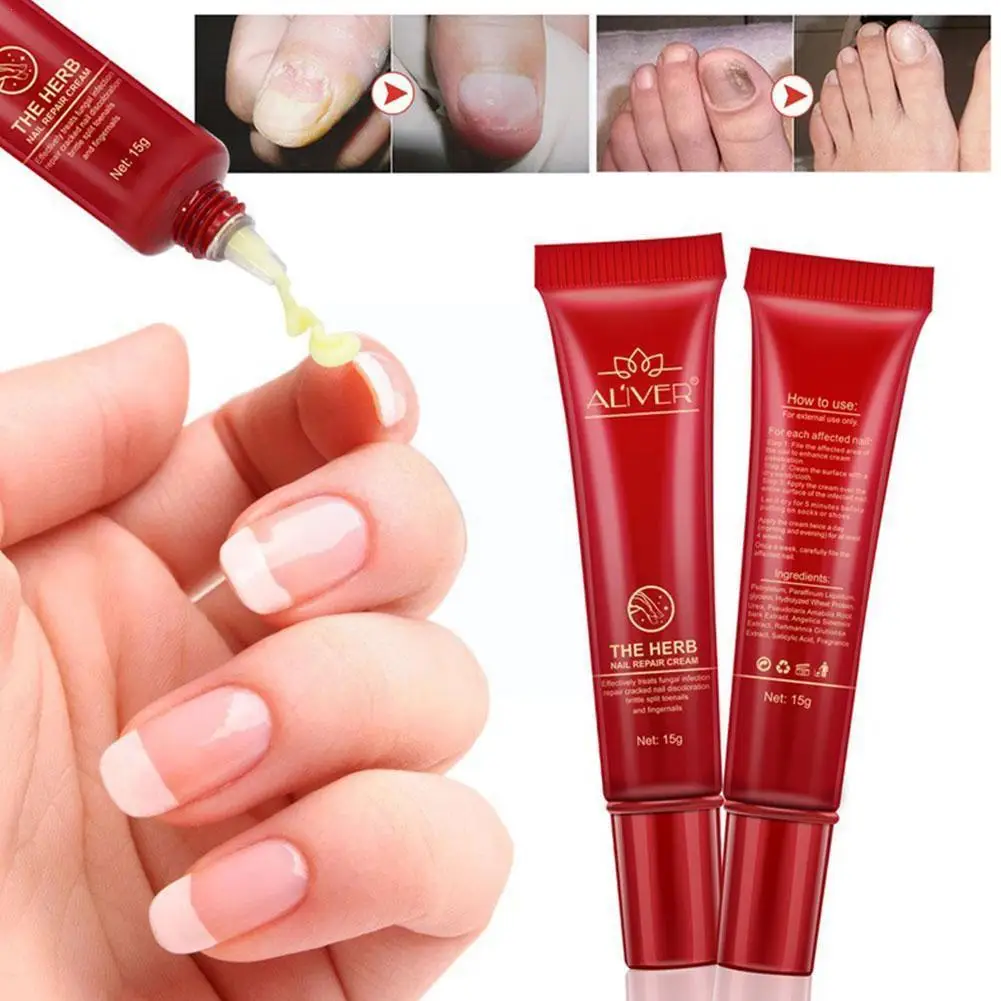 

15ml Aliver Nail Fungus Treatment Herb Nails Repair Care Tools Care Protector Cream Skin Cream Onychomycosisnail Nail F3U9