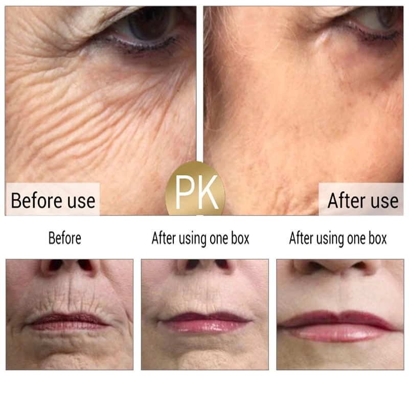 Полипептидный крем для удаления морщин лифтинг лица укрепляющий антивозрастной