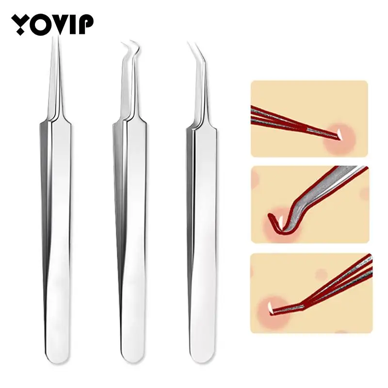 

1pcs Comedone Extractor Blackhead Blemish Pimples Removal Pointed Bend Gib Head Acne Needle Tweezers Face Care Tools