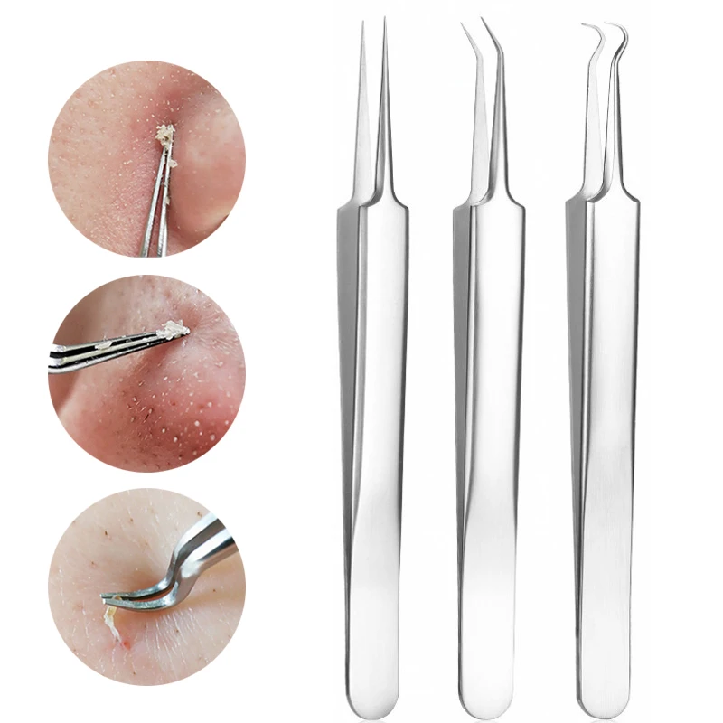 1 шт. игла для удаления чёрных точек на лице |