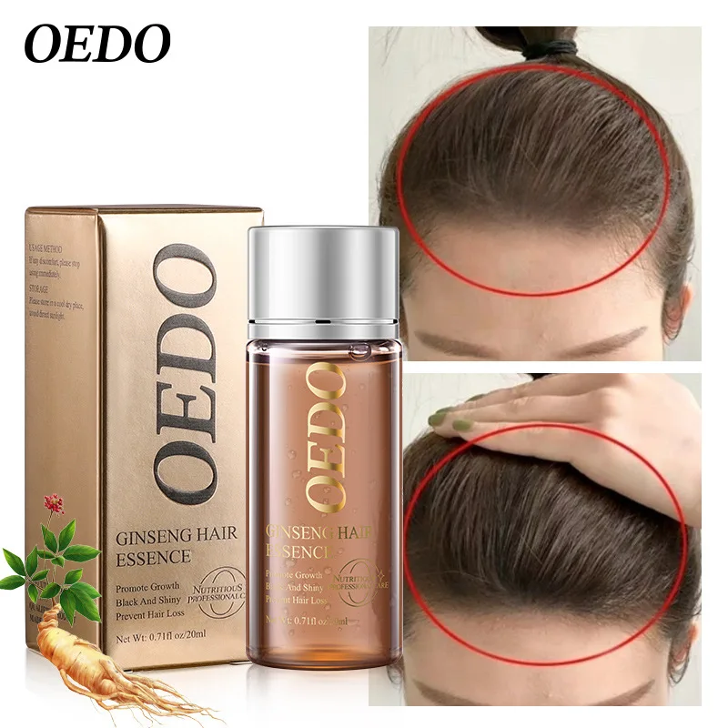 2PCS Ginseng Hair Treatment Essential Oil Intensive Repair Hair Fast Growth Hair Repair Frizz Hair Smooth Hair Care Conditioner