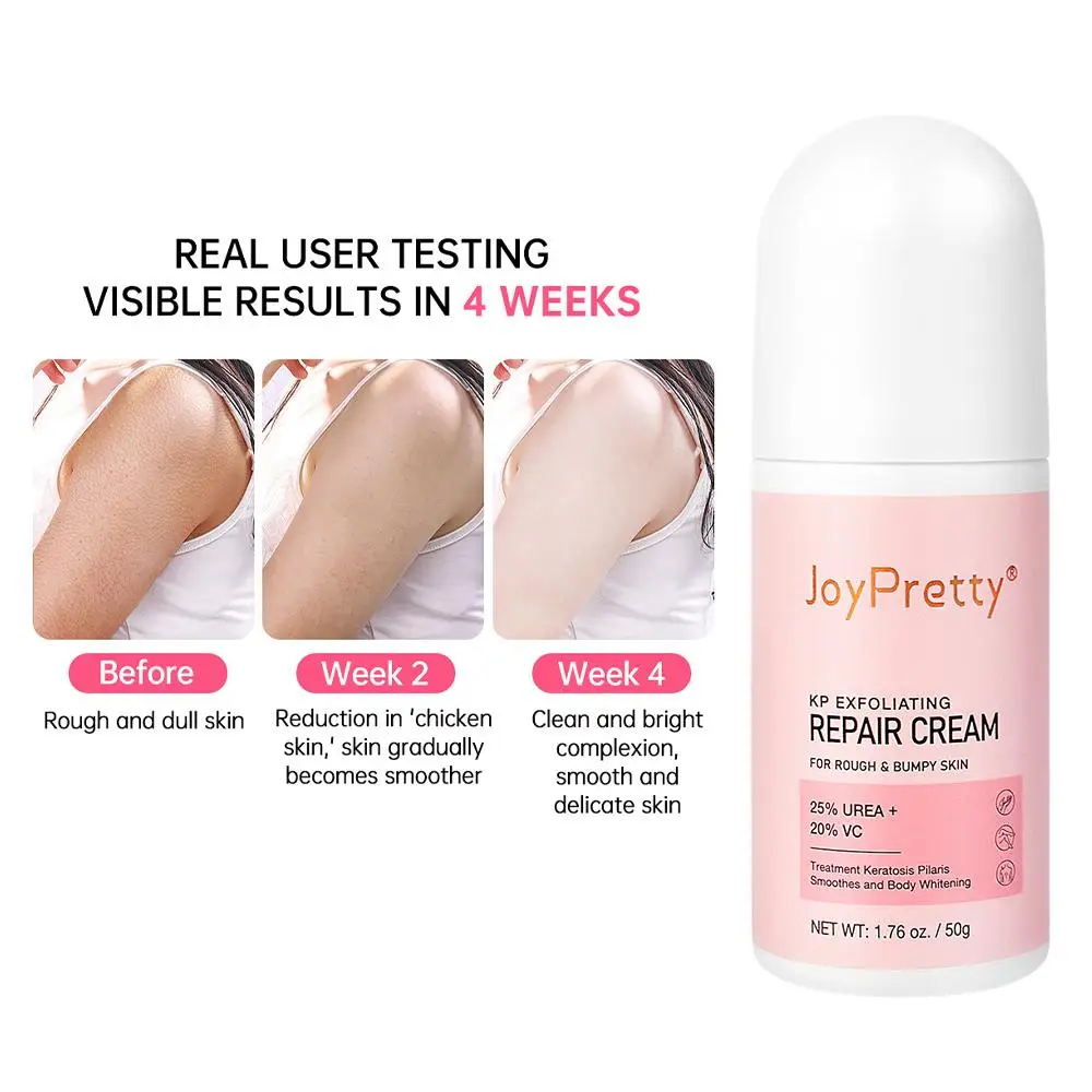 

Body Cream Chicken Skin Removal Treatment Keratosis Pilaris Rough Whitening Bumps Chicken Skin Lotion Care Smooth Goose Ski Q7L4