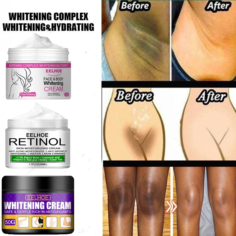 

Body Whitening Cream Private Parts Underarm Bleaching Serum Remove Melanin Pigmentation Brighten Inner Thigh Intimate Dark