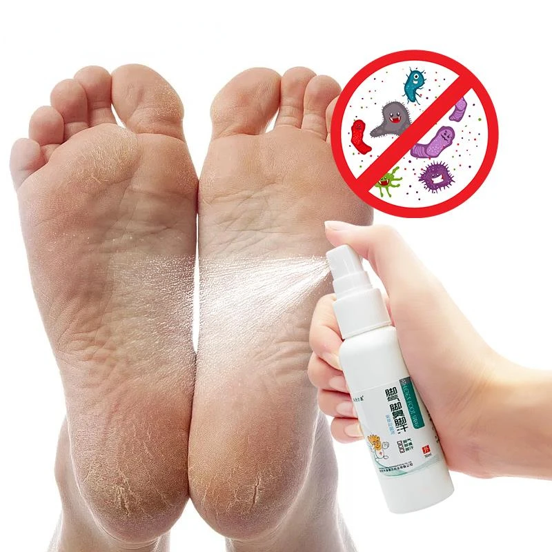 1 шт., травяной лечебный спрей для лечения грибка