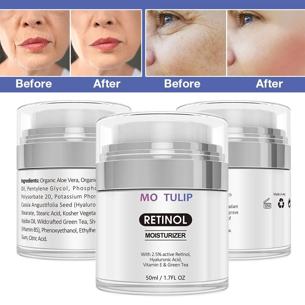 

MO TULIP Retinol 2.5% Moisturizer Cream Anti Aging and Reduces Wrinkles and Fine Lines Day and Night Retinol Cream DROP SHIP