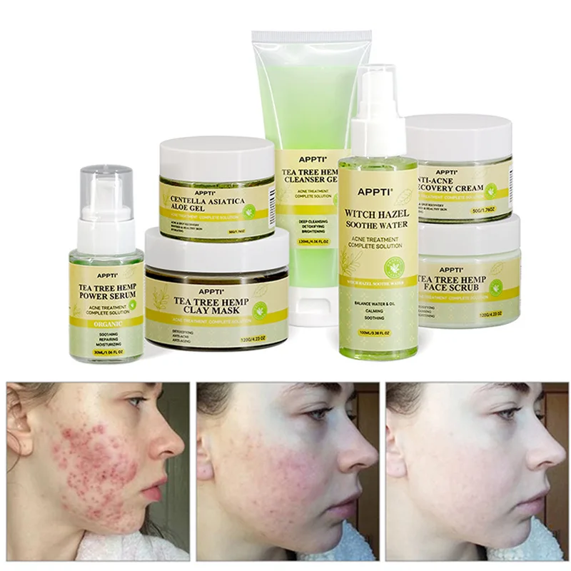7PCS Tea Tree Acne Treatment Facial Care Set Efectively Remove Blackhead Acne Scar Shrink Pore Repair Serum Cream Skin Care Kit
