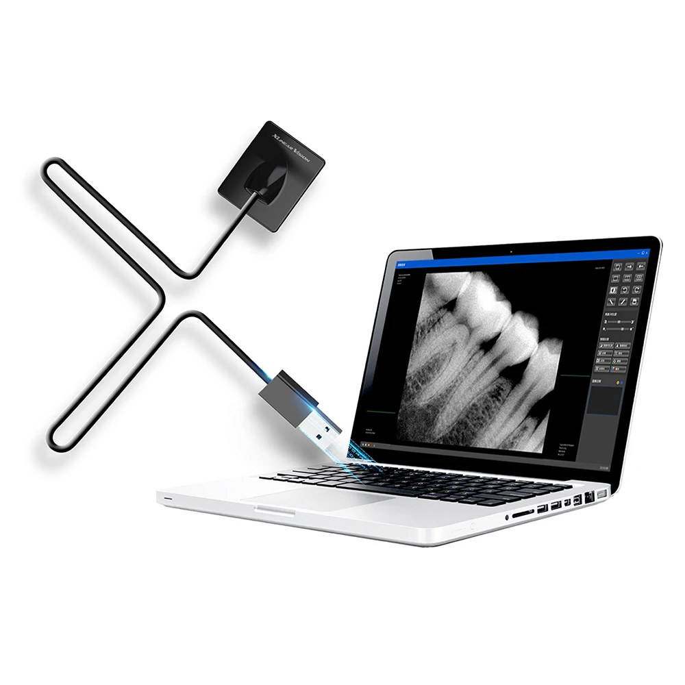 

Intraoral Dental USB Direct Digital X-ray Sensor System