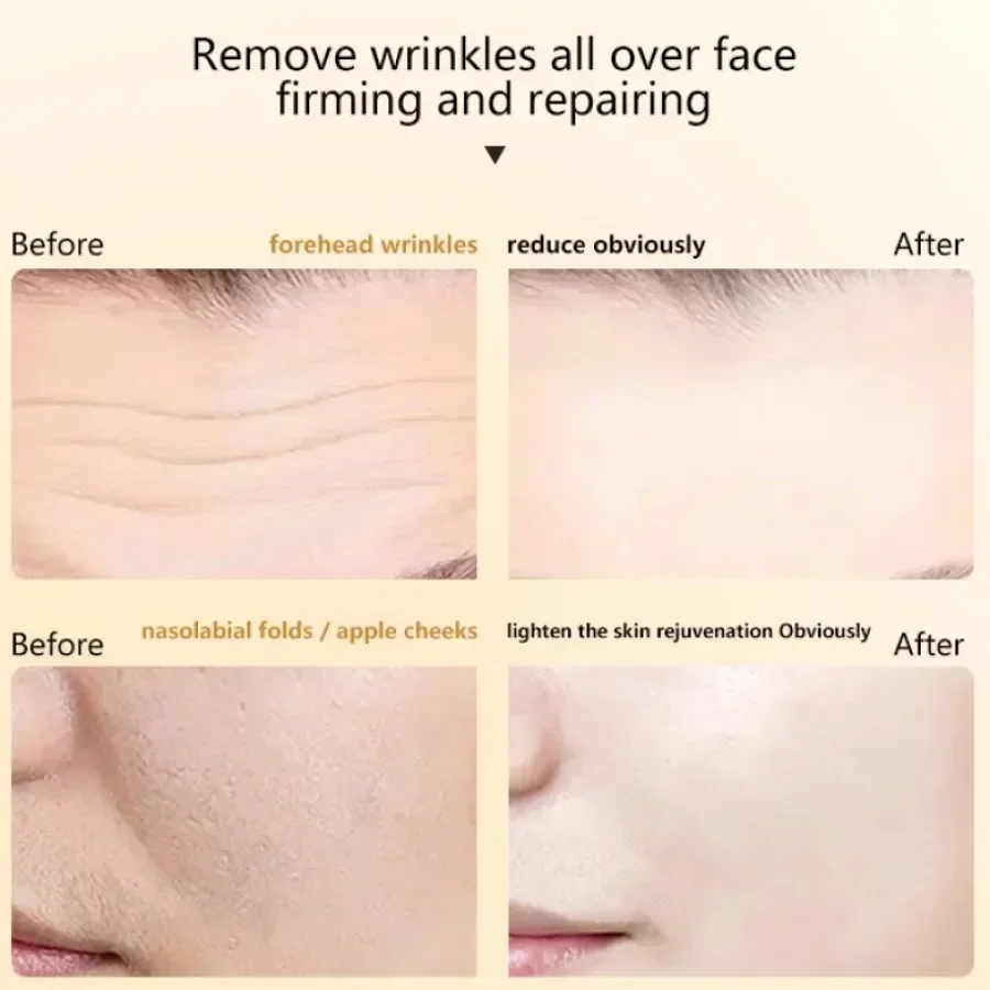 Радиочастотный инструмент для красоты домашний импорт коллагена новая