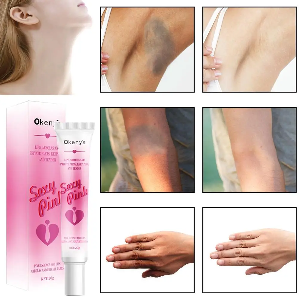 

20g Body Whitening Cream Intimate Area Tender Red Essence Lip Beauty Butt Facial Remove Underarm Knee Care Dullness G5Z5