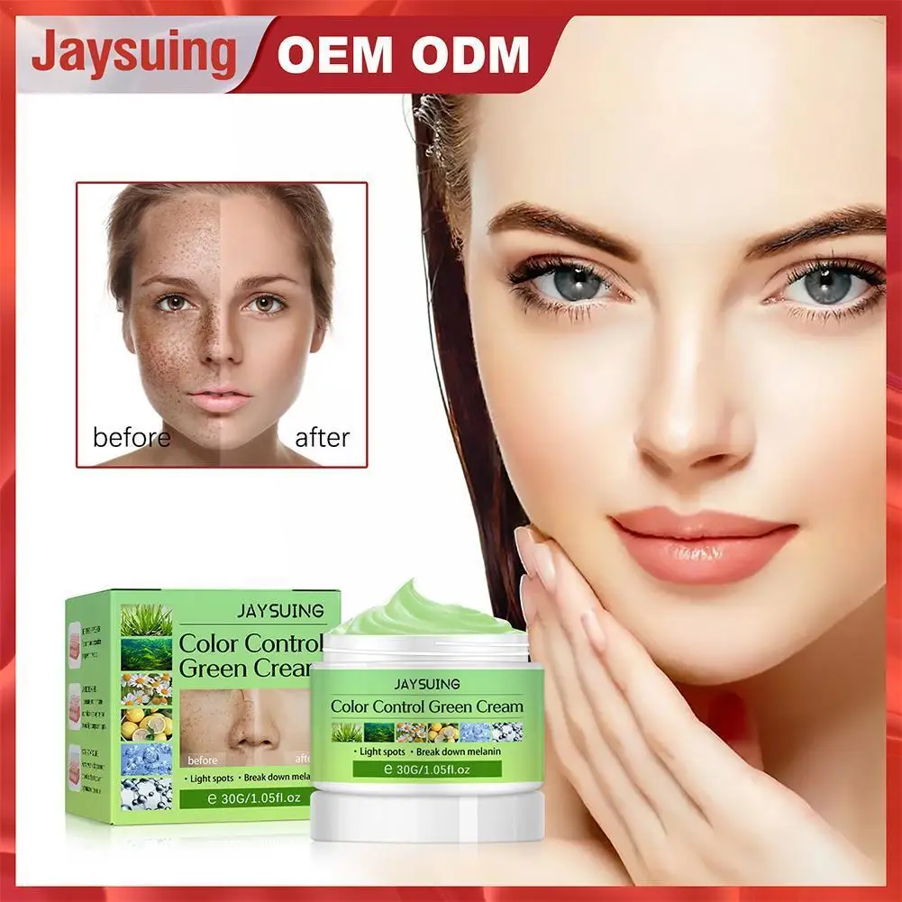 

Whitening Freckles Cream Remove Melasma Dark Spots Lighten Melanin Firming Cosmetics Hyaluronic Acid Moisturizing Whitening