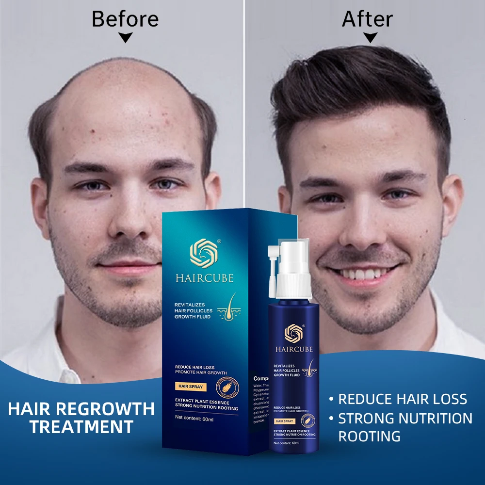 

60ml Fast Hair Growth Essence Spray Natural Herbal Anti-Hair Loss Treatment Products Hair Growth Longer and Thicker Hair Care