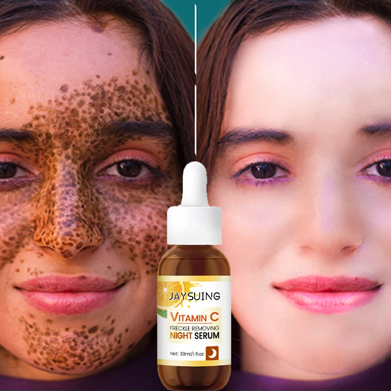 Effective Whitening Freckle Removal Serum Fade Dark Spots Melasma Anti-Aging Vitamin C Essence Liquid Fast Brighten Skin Care