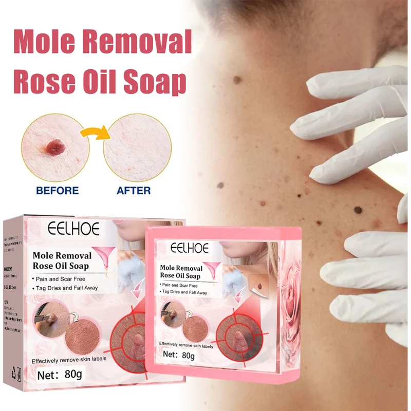 

80g Wart Removal Rose Oil Soap Cleaning Nourishing Oil-Control Whitening Black Spot Wart Removal Soap Face Soap Skin Care