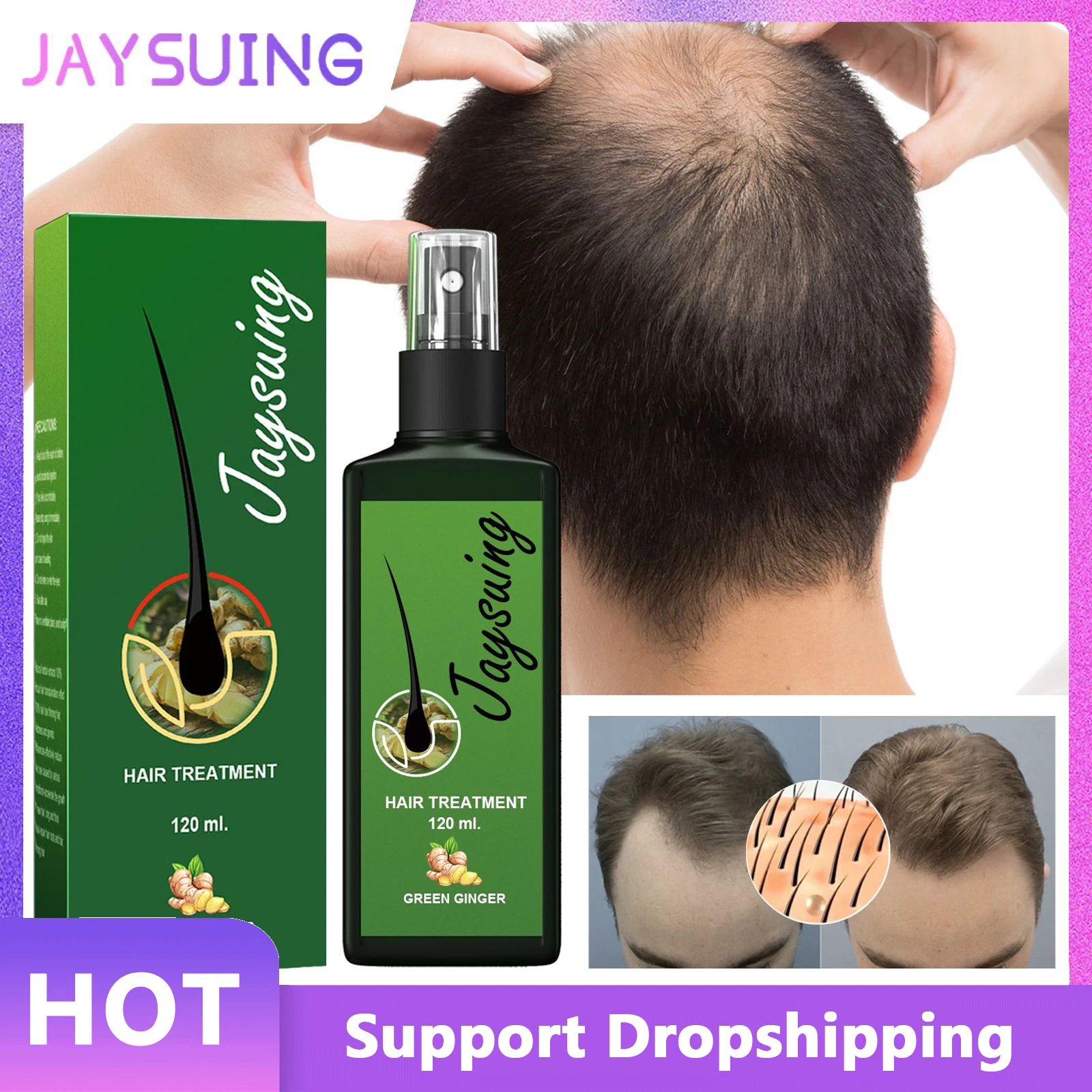 Jaysuing Hair Growth Spray Effective Nourishing Root Hair Thick Growth Liquid Anti-fall Scalp Massage Repair Spray Free Shipping