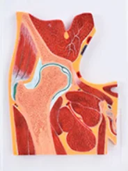 Модель профиля бедрового сустава медицинская наука артроз анатомический