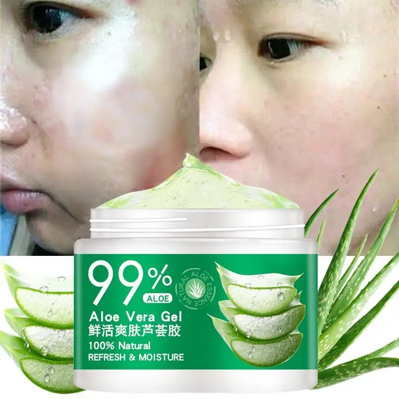 

lNatural Face Creams Moisturizer Acne Treatment Scar Repair Gel for Skin Repaire skin care