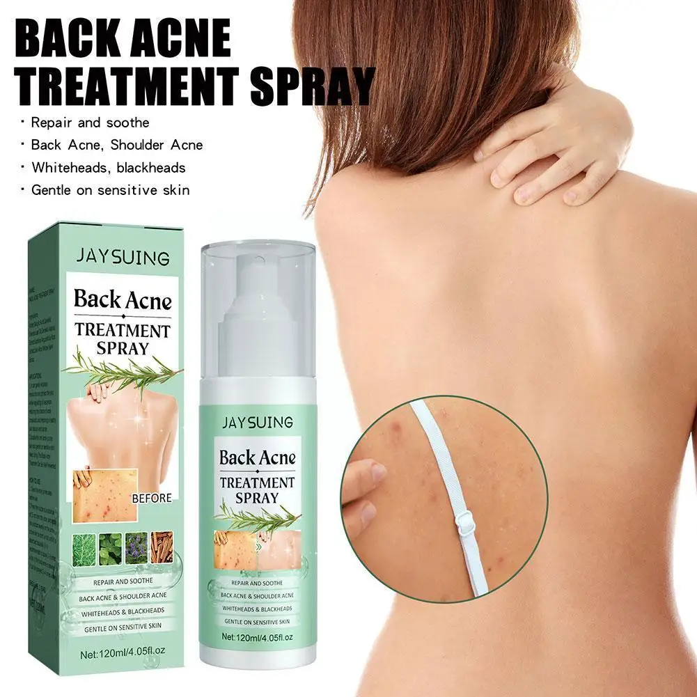 

Спрей для лечения акне на лице, увлажняющая сыворотка для ухода за пятнами, 120 мл