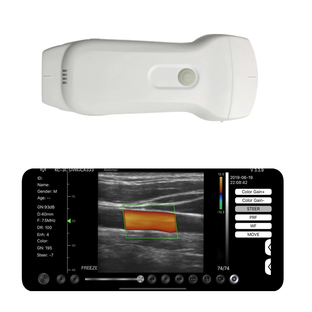 Беспроводной ультразвуковой зонд Wi-Fi 3 в 1 двойная головка для Android IOS Apple Windows 128