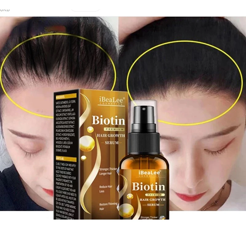 

2023 Hair Growth Products Biotin Fast Growing Hair Care Essential Oils Anti Hair Loss Spray Scalp Treatment for Men Women