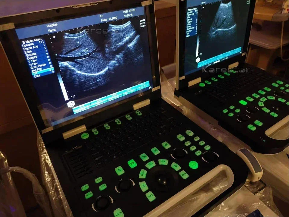 Ветеринарный ультразвук DP 50 ветеринарный Mindray портативный цветной доплеровский