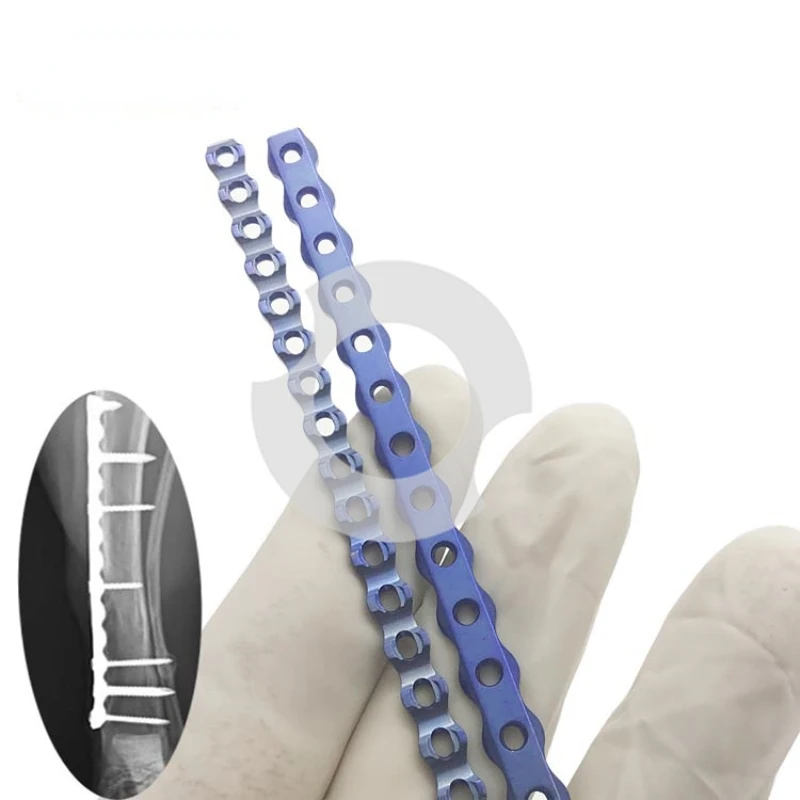 

Стопорная костная пластина из титанового сплава, ортопедический инструмент, Alps Point Connection P Touch plus R, ножницы для прессования C Cut L7.5/8,5 мм