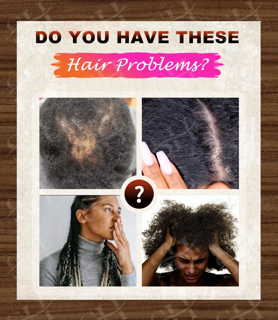Сумасшедшее масло для роста волос Essencel африканская тяга порошок Alopecia Chebe