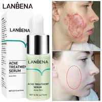 lanbena salicylic acid acne treatment anti acne solution face serum shrink pores repair pimples whitening dark spots skin care