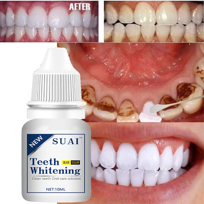 

Teeth Whitening Essence Serum Remove Plaque Stains Bleach Oral Hygiene Tooth Whitening Blanchiment Dentaire Clareador Dental