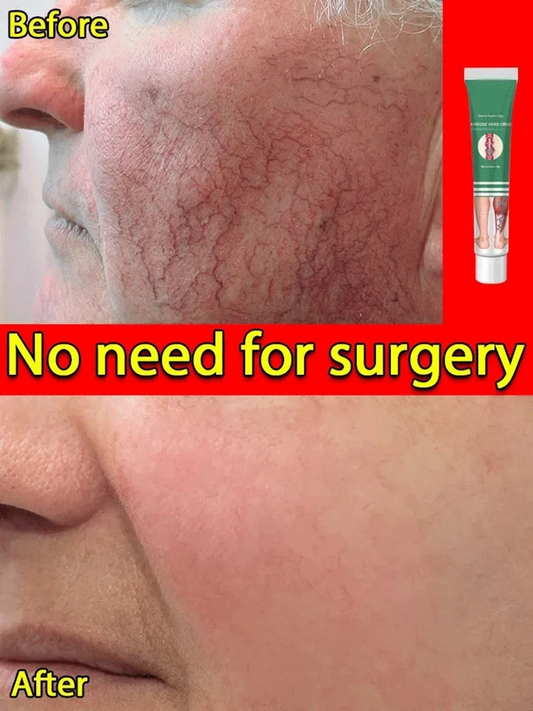 Крем для ног с рисунком паутины