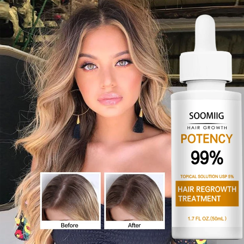 

Hair Growth Serum Essential Oil Anti Hair Loss Spray Products Ginger For Treatment Dry Frizzy Damaged Thin Hair Nourish Care