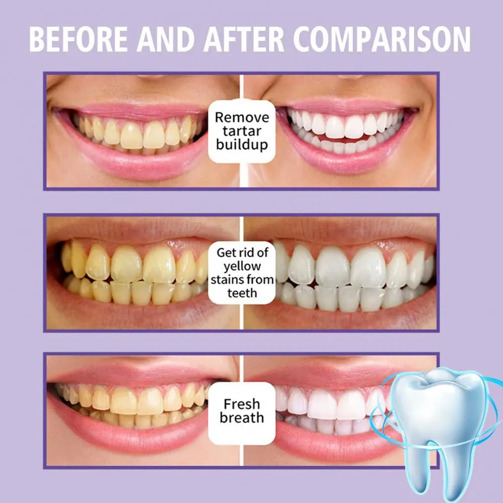 

Multipurpose Universal Stain Removal Whitening Toothpaste Oral Care Whitening Toothpaste High Efficiency for Daily Use