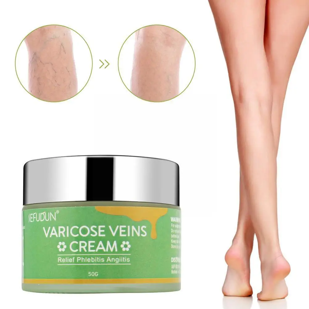 

Крем для лечения варикозного расширения вен, 50 г