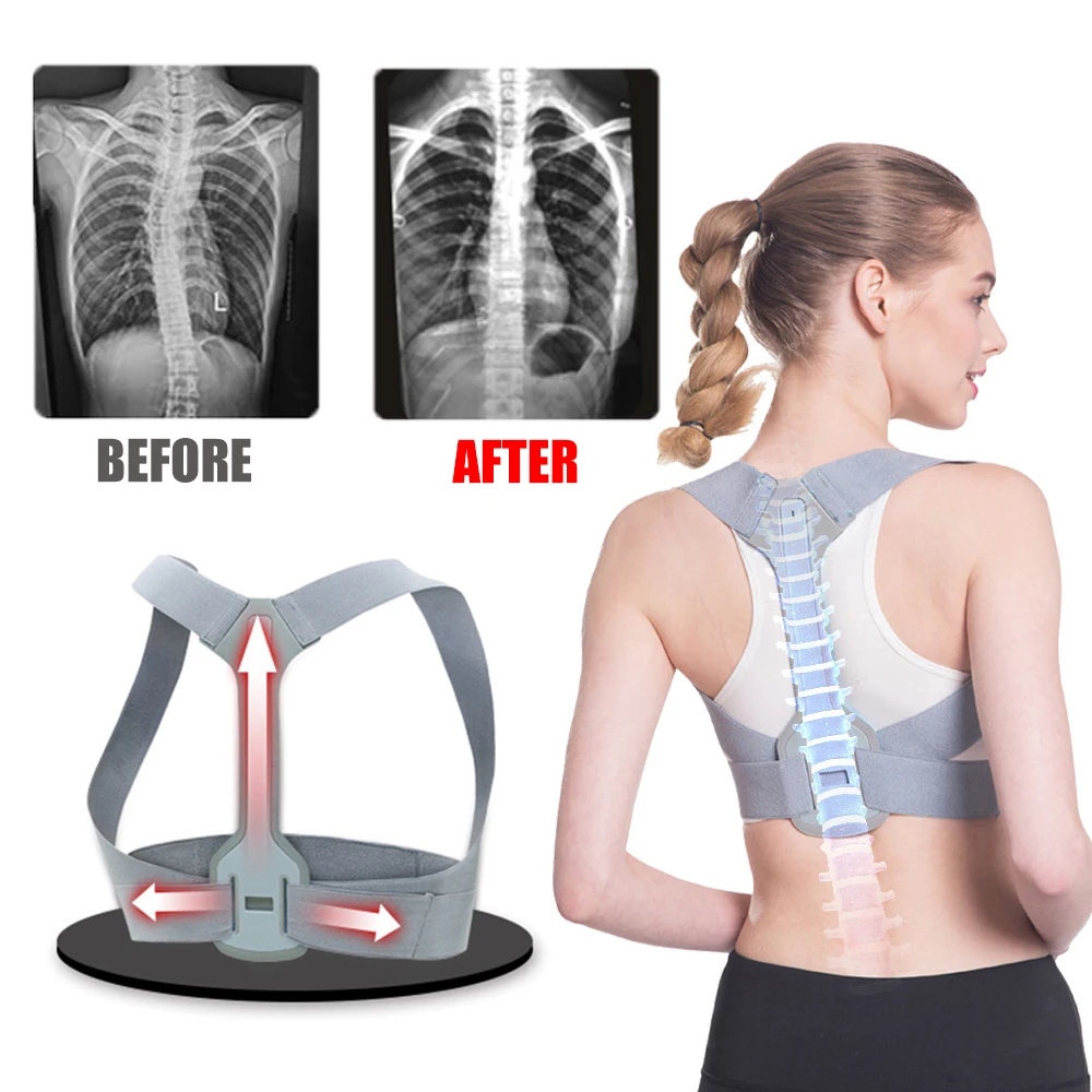 

Medical Posture Corrector Back Shoulder Support Corector Band Adjustable Brace Correction Humpback Pain Relief Belt Health Care