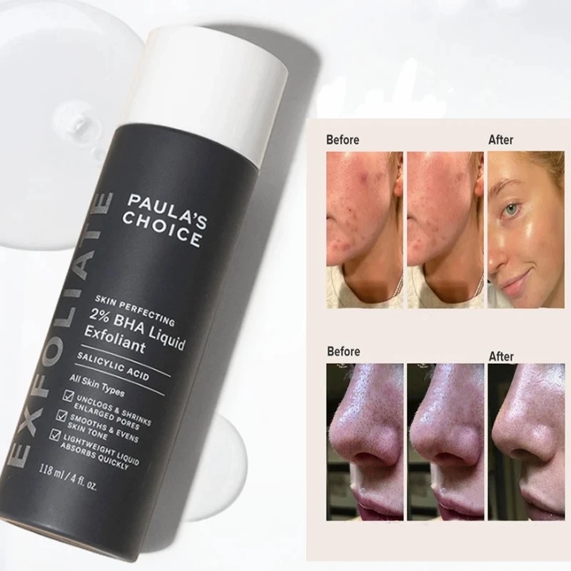

Paulas Choice SKIN PERFECTING 2% BHA Liquid Salicylic Acid Exfoliant Facial Exfoliant for Blackheads Enlarged Pores 118ml