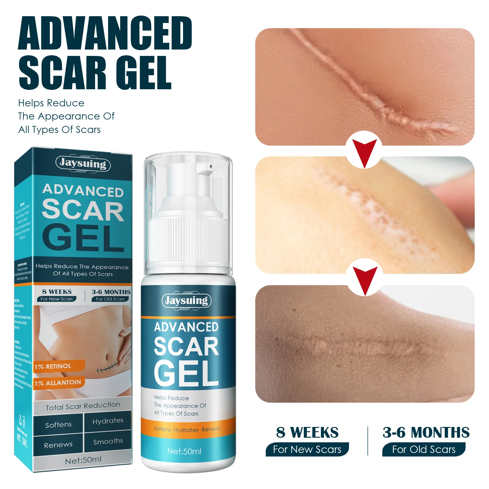 

Advanced Scar Gel Repair Scarred Skin Scar Treatment Cream Smoothing Firming Skin Scar Remover Skin Care for Women and men