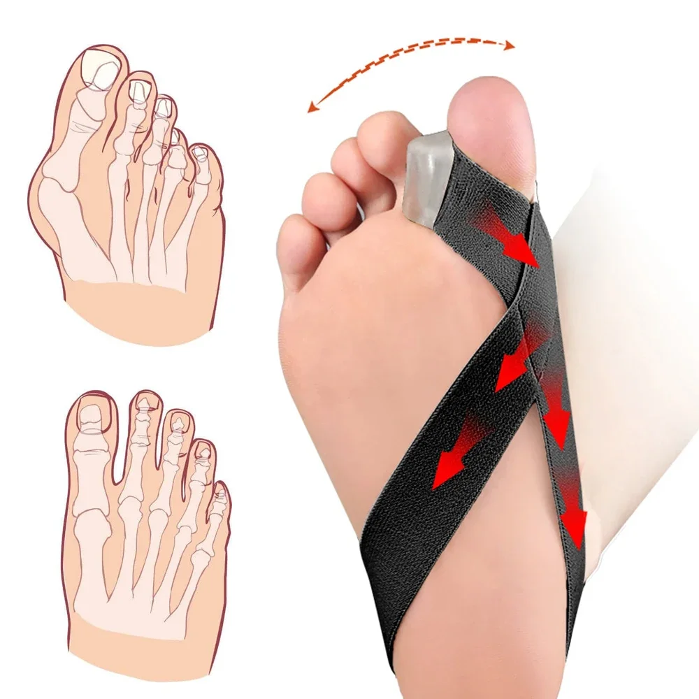 1 шт. магнитный сепаратор ремня-нехирургическая коррекция вальгусной деформации