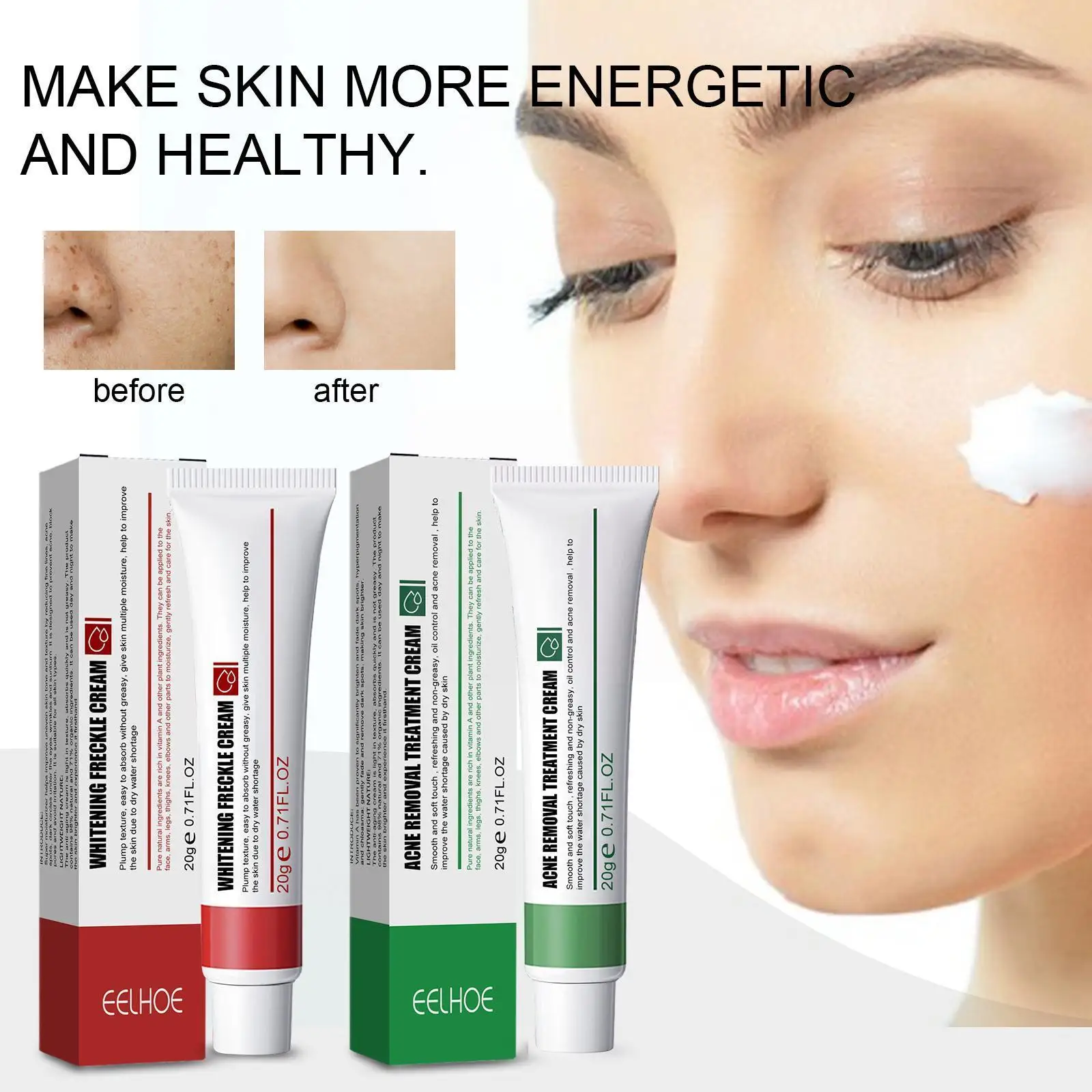 

20g Freckle Cream Whitening Remove Dark Spots Melasma Moisturizing Skin Face Brighten Anti-aging Cream Acne Care Treatment W2d9